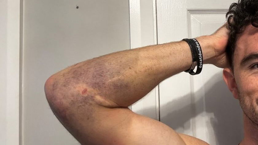 Glenn Irwin injury
