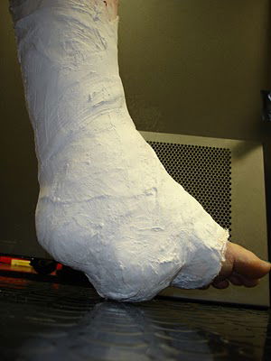 Biker groom breaks leg on wedding day after receiving a text saying