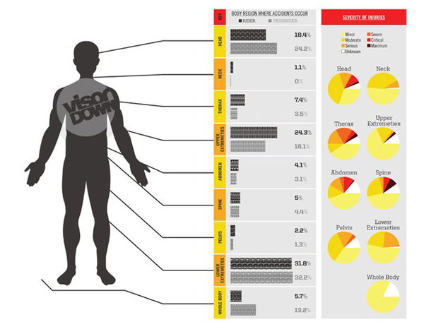 Motorcycle accident? Here's where you're most likely to get injured