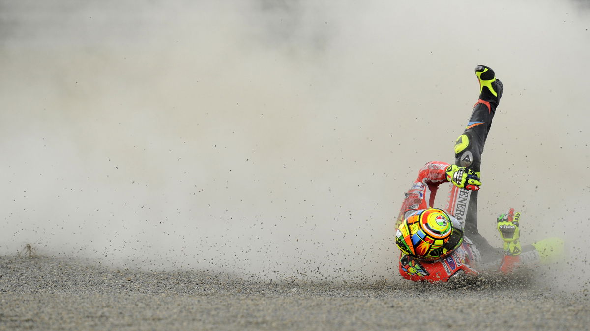 Rossi breaks little finger