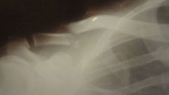 'Careless cyclist' prosecuted for injuring biker