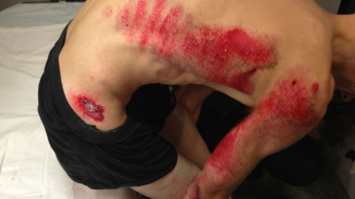 Police warning to 'T-shirt and shorts' bikers