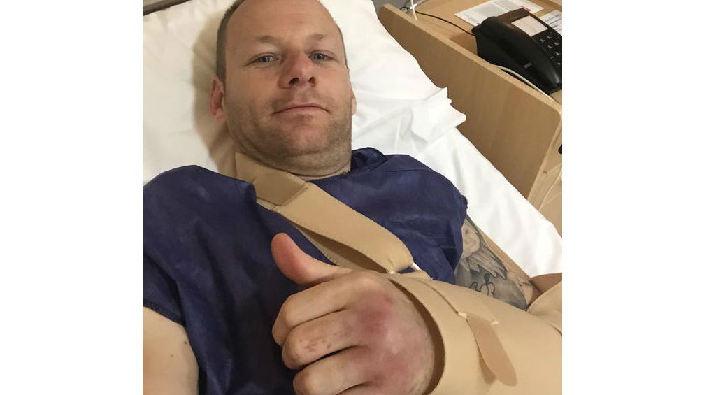 Shane Byrne undergoes surgery on broken hand