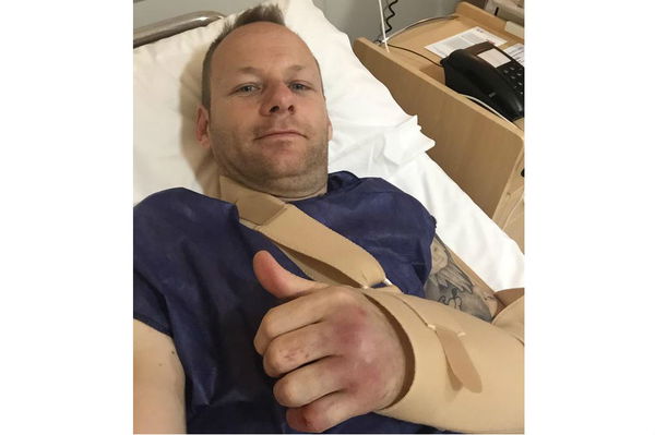 Shane Byrne undergoes surgery on broken hand