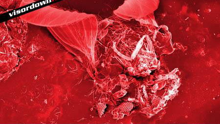 Bug splats: the microscopic truth!